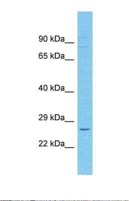 Polyclonal Rabbit anti-Human CD209 / DC-SIGN Antibody (C-Terminus, WB)