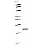 THRA / THR Alpha Antibody (clone 948C3a)