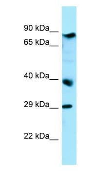 Polyclonal Rabbit anti-Human BRAT1 / BAAT1 Antibody (aa709-758, WB)