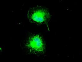 CTAG1B / NY-ESO-1 Antibody (clone OTI3F10)