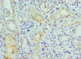 MAPK7 / ERK5 Antibody (aa1-310)