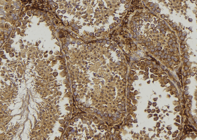 FXN / Frataxin Antibody