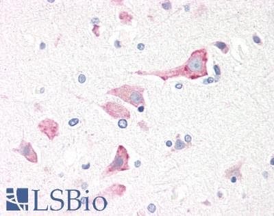 Polyclonal Goat anti-Human RPS19 / Ribosomal Protein S19 Antibody (aa111-122, IHC, WB)