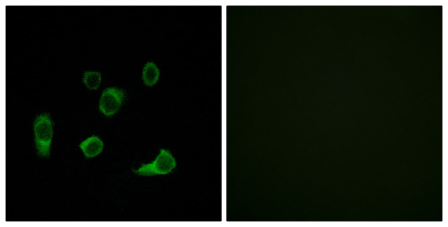 AUTL1 / ATG4C Antibody (aa21-70)
