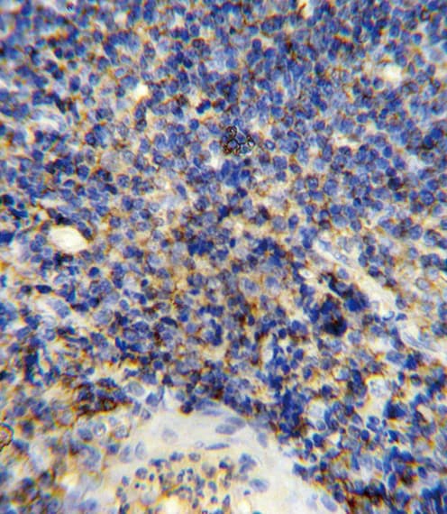 CD45 / LCA Antibody (aa1245-1275)
