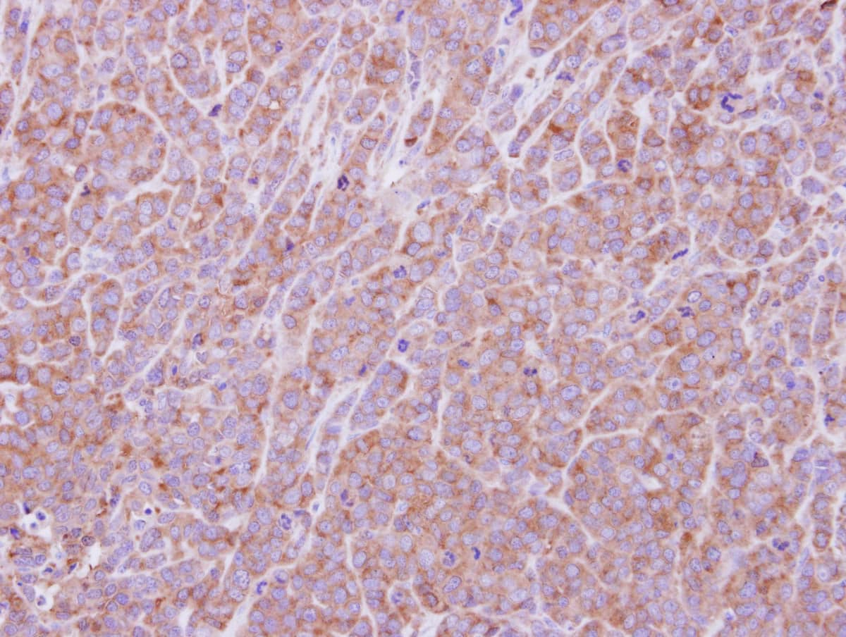 Polyclonal Rabbit anti-Human EIF2B1 Antibody (IHC, WB)