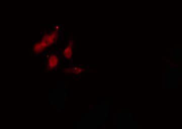 PMS2 Antibody