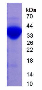 Rat PLG / Plasmin / Plasminogen Protein (Recombinant His, N-Terminal)