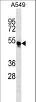 Polyclonal Rabbit anti-Human TRIM54 / MURF Antibody (aa1-30, IHC, WB)