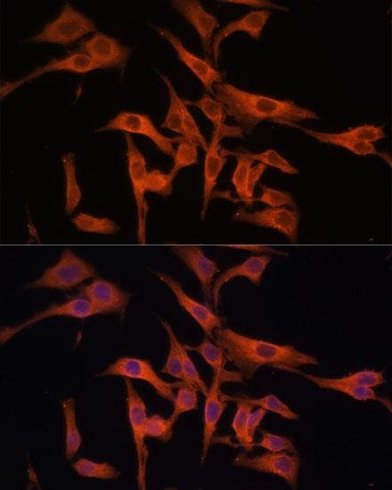 LGMN / Legumain Antibody