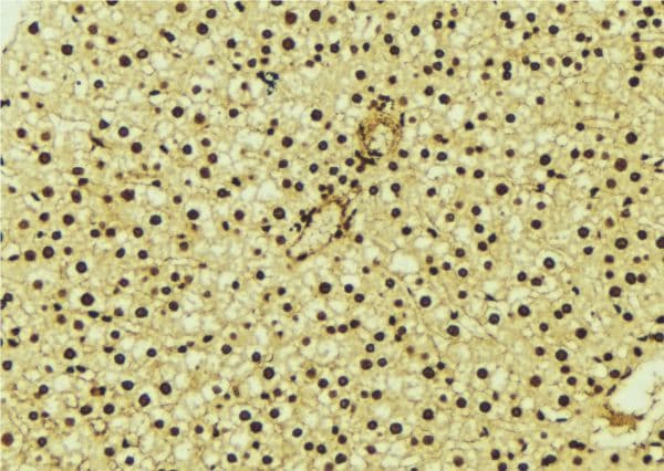Polyclonal Rabbit anti-Human HURP / DLGAP5 Antibody (IHC, IF, WB)