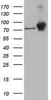 CTNNB1 / Beta Catenin Antibody (clone OTI12C1)