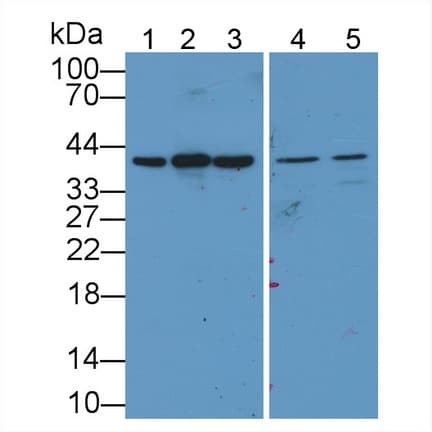 GAPDH Antibody (aa2-148)