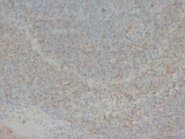 CHEK2 / CHK2 Antibody (C-Terminus)