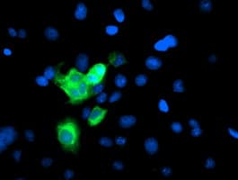 CYP2A6 Antibody (clone OTI3C1)