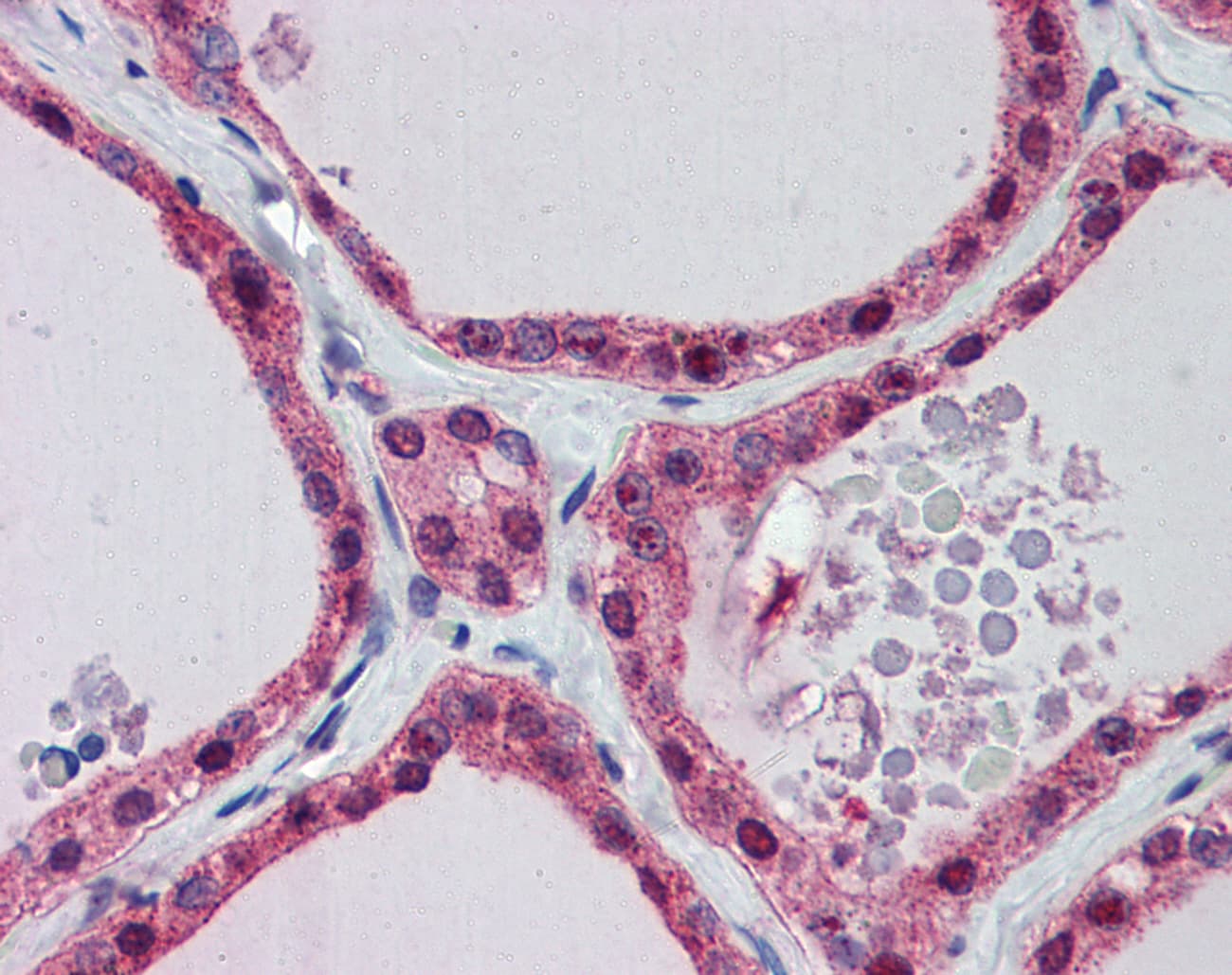 PGK1 / Phosphoglycerate Kinase Antibody (aa102-151)
