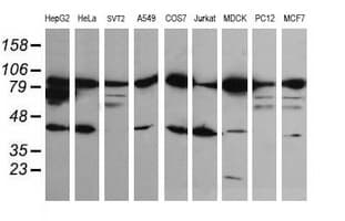CTNNB1 / Beta Catenin Antibody (clone OTI9C1, Carrier-free)