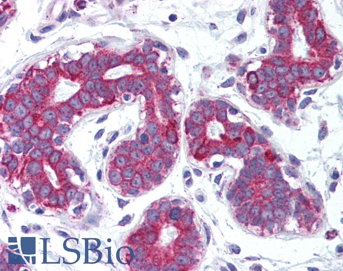 IHC-plus™ TNFSF11 / RANKL / TRANCE Antibody