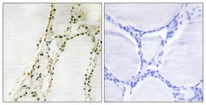 Polyclonal Rabbit anti-Human RPS6KA2 / RSK3 Antibody (aa241-290, IHC)