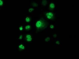 TP53 / p53 Antibody (clone OTI2E4, Carrier-free)