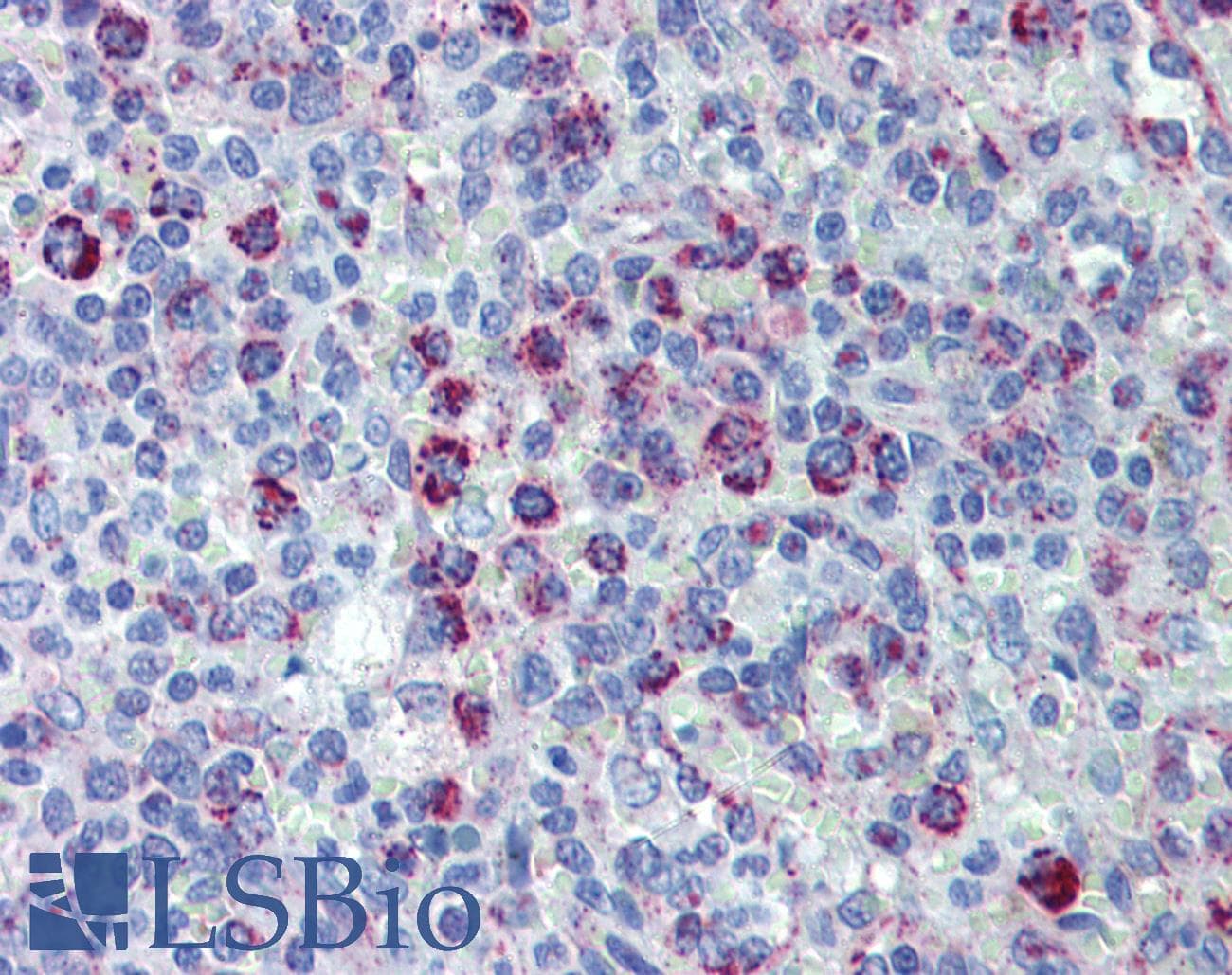 PathPlus™ Polyclonal Goat anti-Human HSPD1 / HSP60 Antibody (IHC, WB)