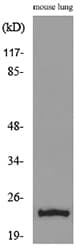 Polyclonal Rabbit anti-Human EDN1 / Endothelin 1 Antibody (WB)