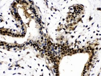 NAMPT / Visfatin Antibody