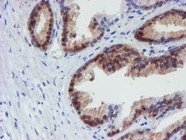 Monoclonal Mouse anti-Human Mannose Phosphate Isomerase Antibody (clone OTI4E7, IHC, WB)