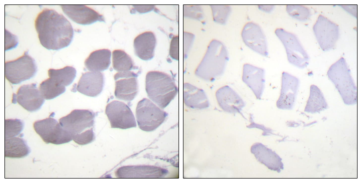 PRKAB1 / AMPK Beta 1 Antibody (phospho-Ser181)