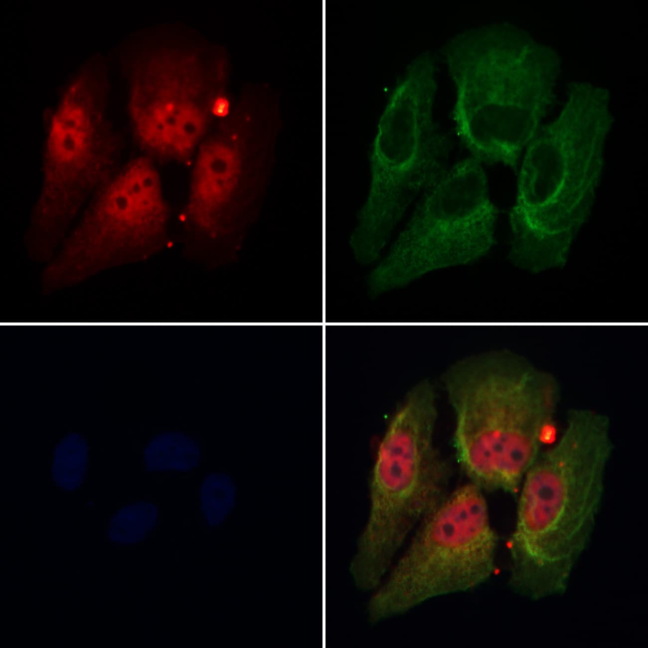 Polyclonal Rabbit anti-Human DDX17 Antibody (IF, WB)