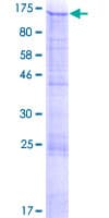 Human MATN2 / Matrilin 2 Protein (Recombinant GST)