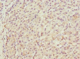 THADA Antibody