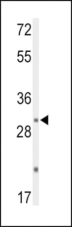 DUSP2 Antibody (aa262-290)