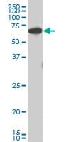 IHC-plus™ CHEK2 / CHK2 Antibody (clone 3E10)