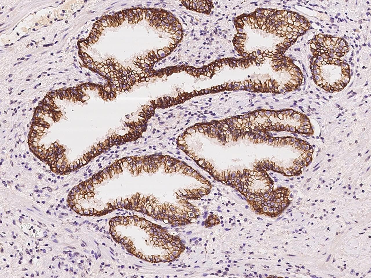 Polyclonal Rabbit anti-Human FXYD3 Antibody (IHC)