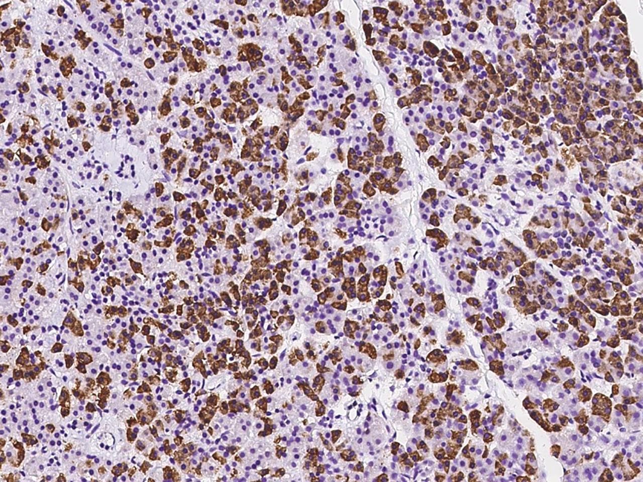 RPS10 / Ribosomal Protein S10 Antibody