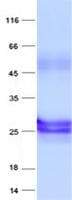 Human NDUFB9 Protein (Recombinant His, N-Terminal)