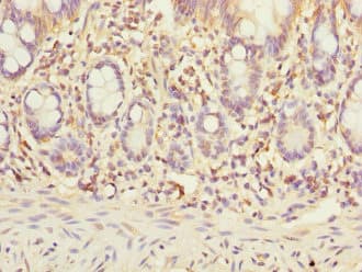 STX7 / Syntaxin 7 Antibody