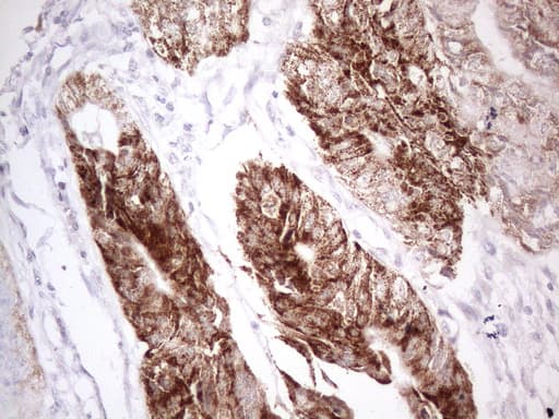 AMACR / P504S Antibody (clone OTI3H10)