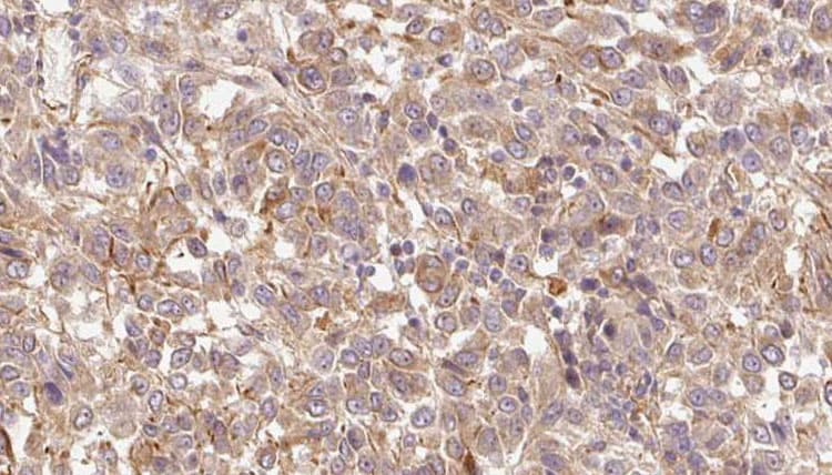 HGFAC / HGFA Antibody