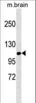IHC-plus™ SIK1 / MSK Antibody (aa567-597)