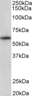 IHC-plus™ TXK / RLK Antibody (aa515-527)