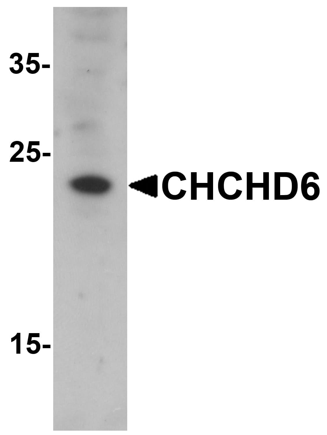IHC-plus™ Polyclonal Rabbit anti-Human CHCHD6 Antibody (IHC, WB)