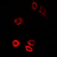 Polyclonal Rabbit anti-Human PIWIL1 / PIWI Antibody (IF, WB)