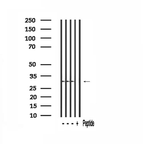 Polyclonal Rabbit anti-Human TSSK3 / STK22C Antibody (WB)