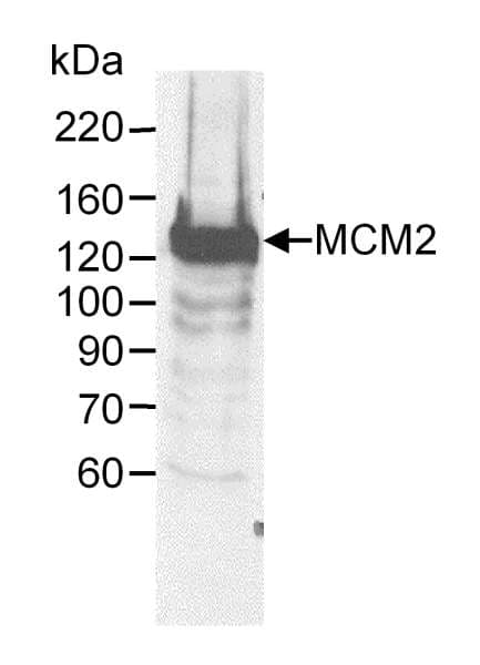 IHC-plus™ MCM2 Antibody (aa1-50)