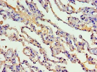 CYP2F / CYP2F1 Antibody (aa100-290)