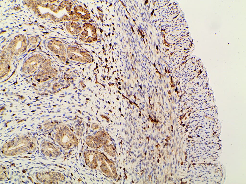 PIK3R1 / p85 Alpha Antibody (phospho-Tyr607)