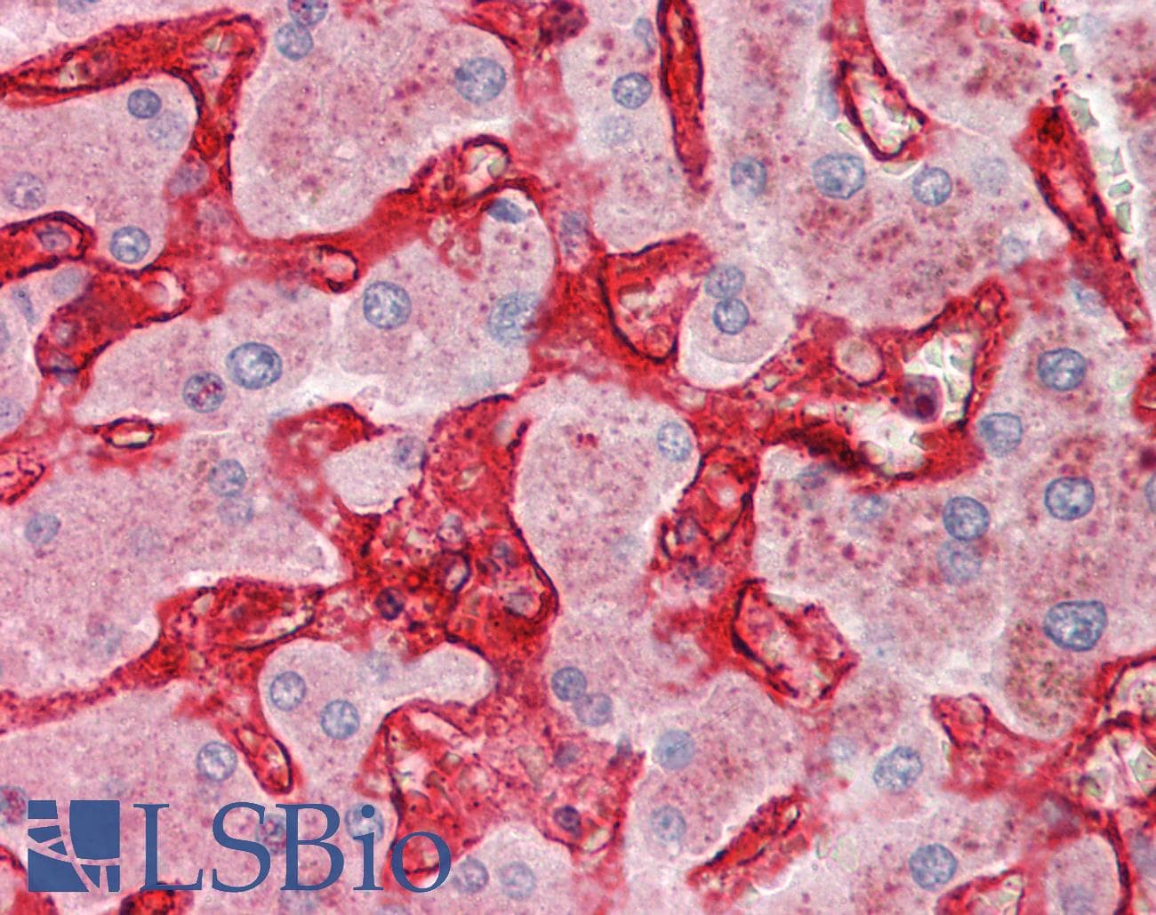 Polyclonal Rabbit anti-Human CLEC4M / L-SIGN / CD299 Antibody (FITC, aa323-372, IHC, WB)