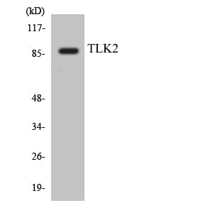 Polyclonal Rabbit anti-Human TLK2 Antibody (aa181-230, WB)